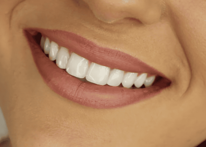 Brits reticent to bare teeth in selfies